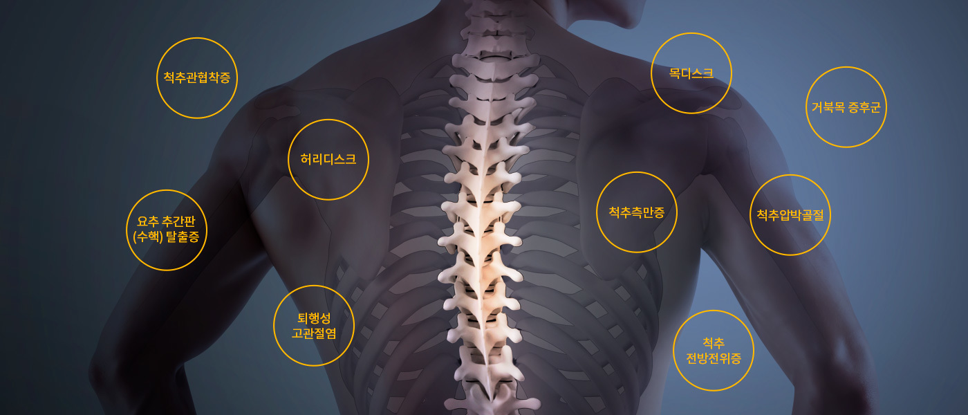 이미지명